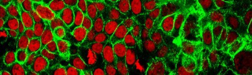 Cell therapy is the process where viable living cells are transplanted or grafted into a human patient to treat or cure a medical condition.  Medical professionals in this audience may particularly be interested in T-cell therapy for cancer treatment or stem cell innovations to treat a variety of ailments.